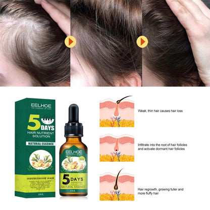 5 Days Ginger Hair Growth Products Natural Anti Hair Loss Prevent Baldness Treatment Fast Growing Nourish Dry Damaged Hair Care - Amazhona 