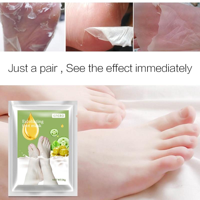 Aloe Vera Foot Mask Peeling For Legs Feet Mask Exfoliating Socks Scrub For Pedicure Anti Crack Heel Remove Skin Foot Patch - Amazhona 