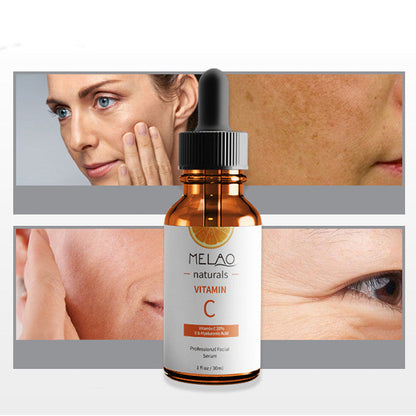 Anti-wrinkle Vitamin C Serum - Amazhona 