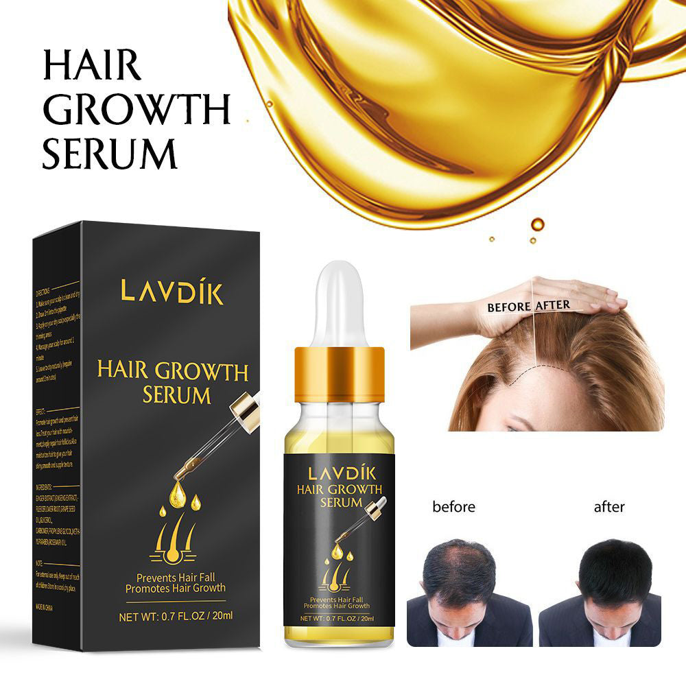 Damaged Hair Repair Women Men's Fast Hair Growth Essence Oil Anti-hair Loss Lotion - Amazhona 