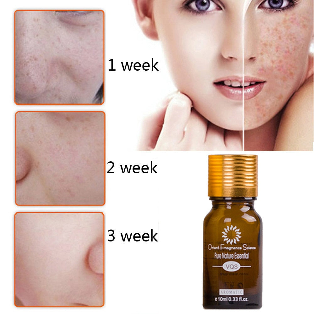 Dredge Meridian Skin Care Natural Pure Removal Acne Stretch Marks Scar Removal Essence oil - Amazhona 