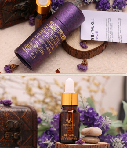 Scar Skin Repair Essential Oil Lavender Essence Care Natural Skin Pure Remove Ance Burn Strentch Marks Removal Scar 10 ML - Amazhona 