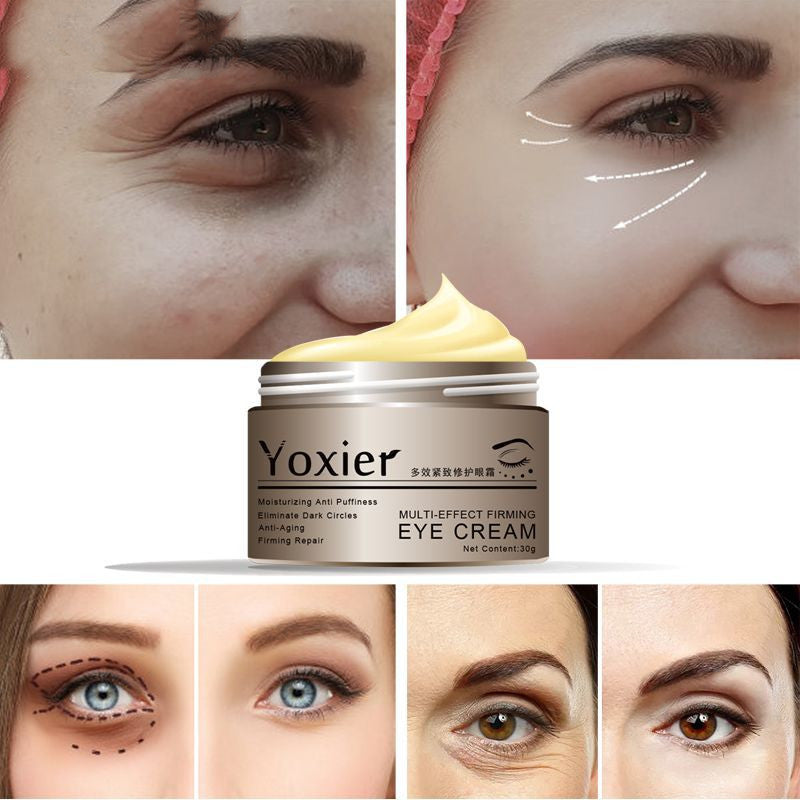 Yoxier Snail Eye Cream Peptide Collagen Dark Circles Korea Cosmetics Patch For Eye - Amazhona 